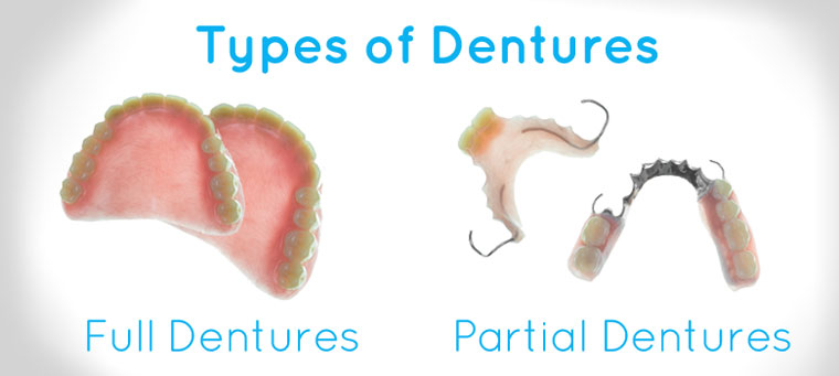 Types of Dentures