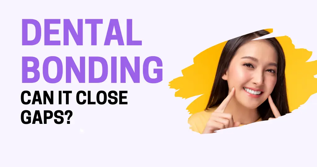 Bonding Blog Header