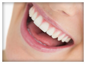 Smile With Porcelain Veneers