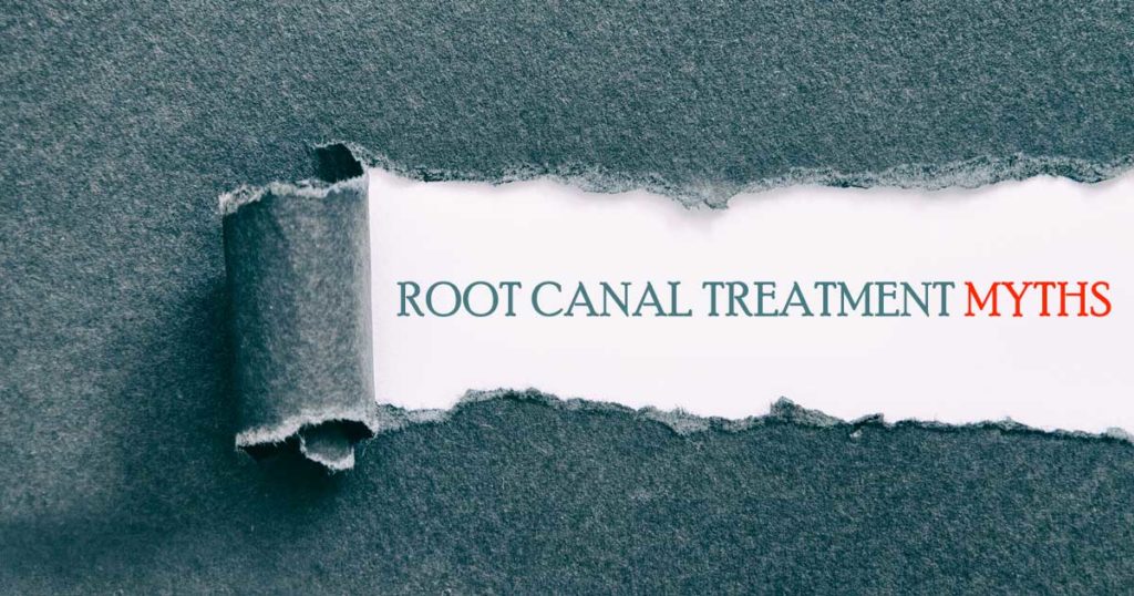 Root canal treatment myths