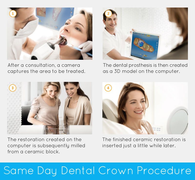 Same Day Dental Crown Procedure Same Day Dental Crown Procedure
